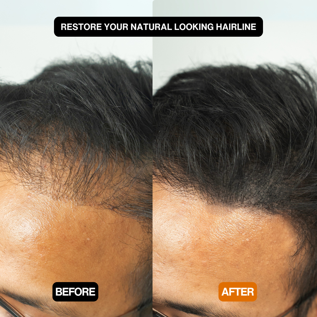 Densify Hair Powder